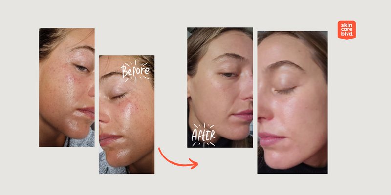 Synbiotic Skin Serum med probiotika