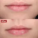NEW 100% Natural Plumping Balm : Hyaluronic Acid & Collagen