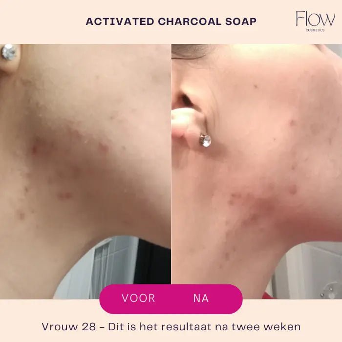 Activated Charcoal & Tea Tree gezichtsreiniger