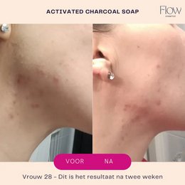 Aktivt kul & Tea Tree ansigtsrens