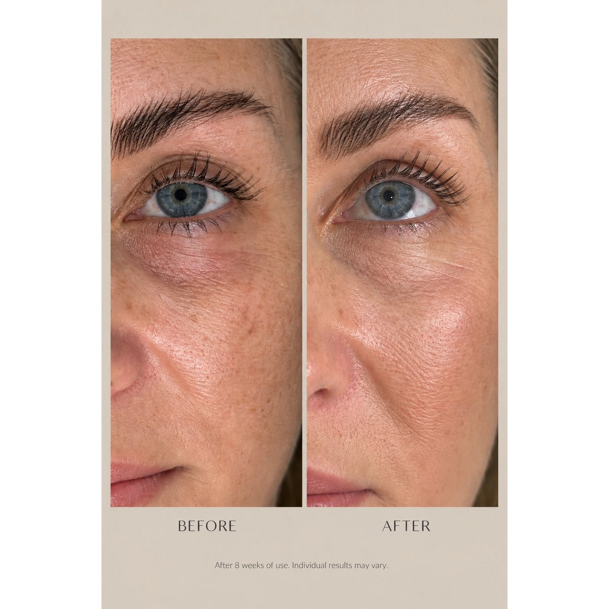 Actif Botanique Contour des Yeux (15 ml)