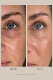 Actif Botanique Contour des Yeux (15 ml)