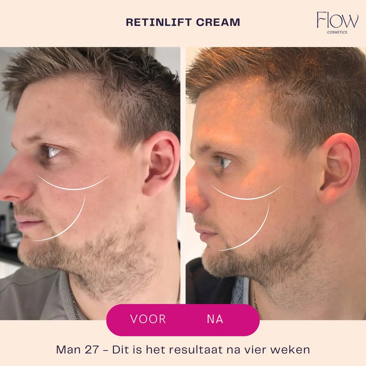 RetinLift 3-in-1 – Retinol-Creme
