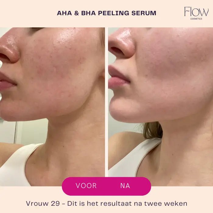 AHA & BHA Peeling Serum - Peeling face