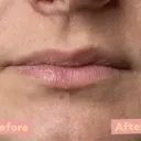 PeelLip - Peeling AHA 5% Marine BHA - Natural & Vegan