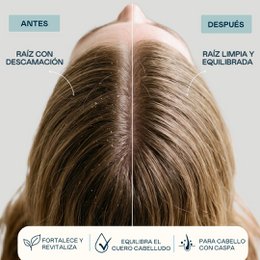 Champú Anticaspa - 0% Sin Sulfatos ni sal