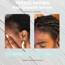 TRÈS[S] GROWN - HAIR GROWTH SERUM