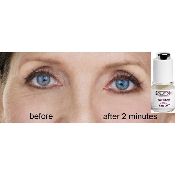 SUPREME DIRECT EYE LIFT - sofortiges Augenlifting - Ergebnisse in 2 Minuten