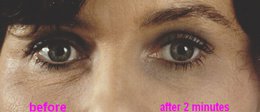 SUPREME DIRECT EYE LIFT - sofortiges Augenlifting - Ergebnisse in 2 Minuten