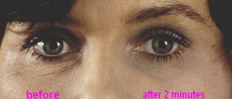 SUPREME DIRECT EYE LIFT - sofortiges Augenlifting - Ergebnisse in 2 Minuten