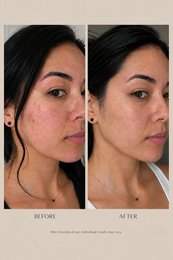 Sérum Essentiel Visage Pro-Âge (30 ml)