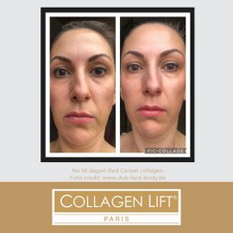 Red Carpet: collagen anti-wrinkle and skin sagging