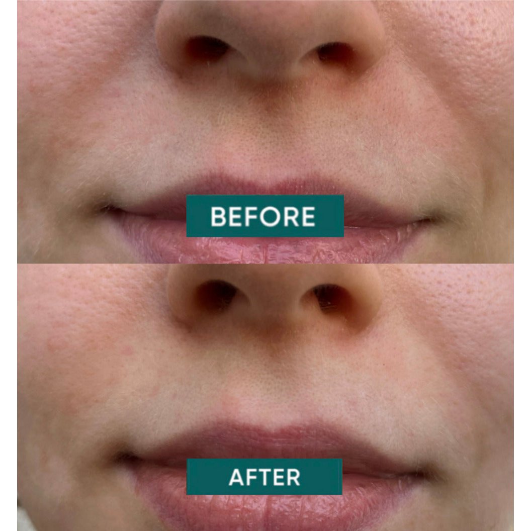 APRICOT Cotton Mouth Patches with Niacinamide