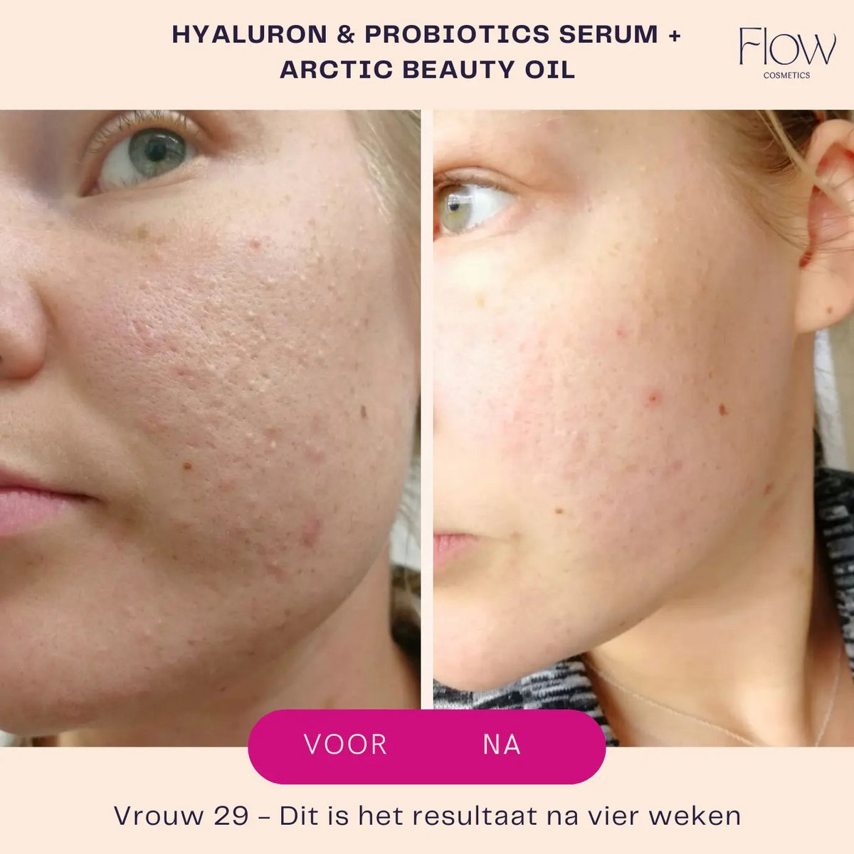 Hyaluron & Probiotics Mini