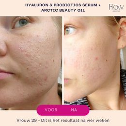 Hyaluron & Probiotics Mini