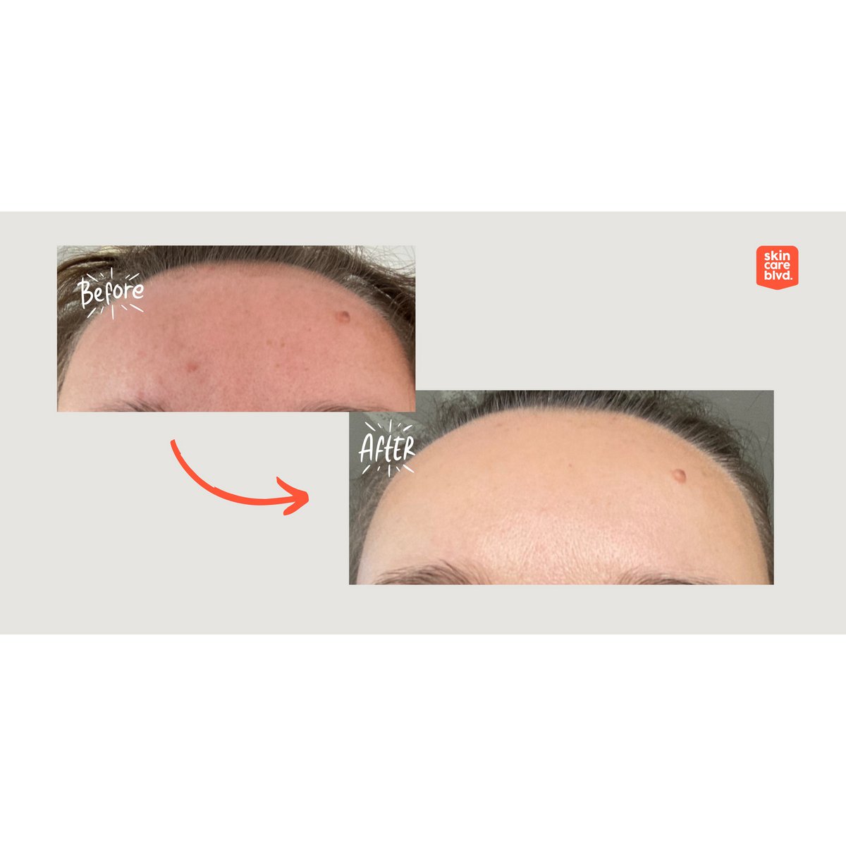 Synbiotic Skin Spray with probiotics 200 ml