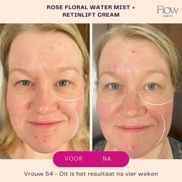 RetinLift 3-in-1 – Retinol-Creme