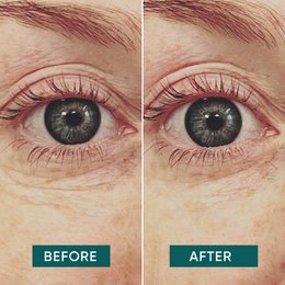 APRICOT Reusable Eye Pads with Hyaluron