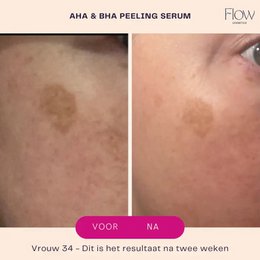 AHA & BHA Peeling Serum - Peeling face