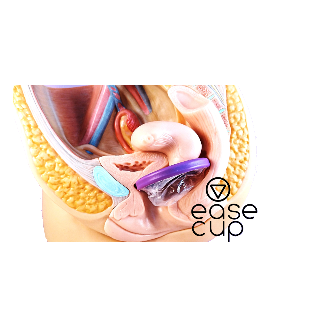 EaseCup - Menstrual disc - flat menstrual cup