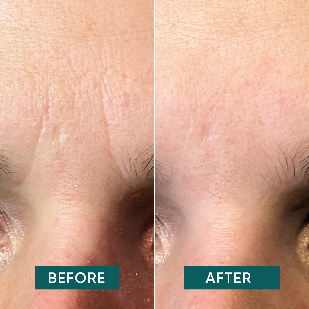 APRICOT Cotton Facial Patches with Hyaluron