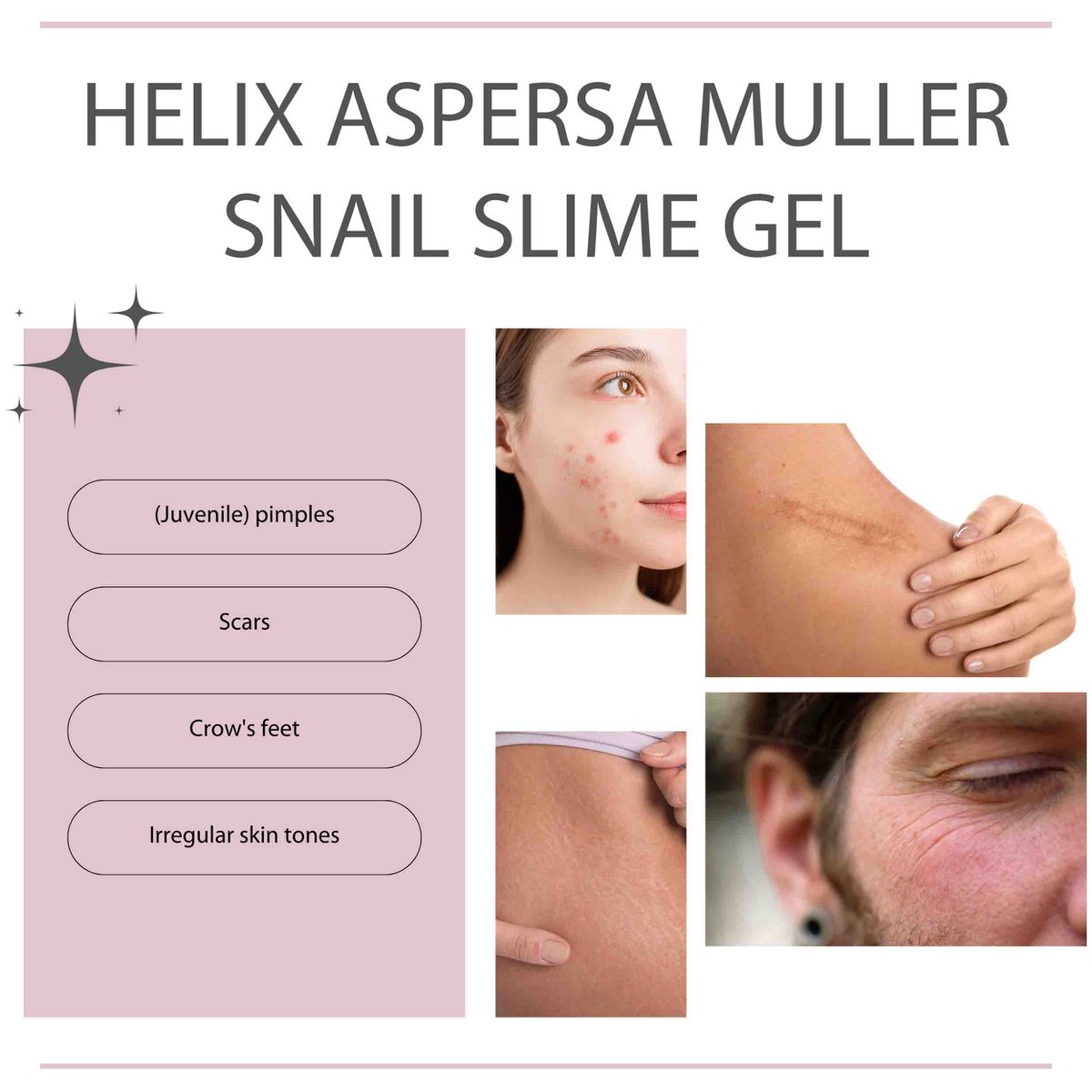 Camille Cosméticos | Gel de baba de caracol - gel de caracol - helix aspersa muller - gel de caracol - baba de caracol - gel corporal - 250ml