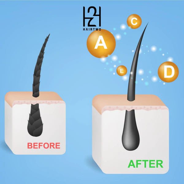 3D BIO-BOOST Hair loss Serum
