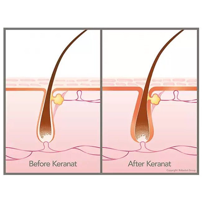 HAIR KOMPLEX PREMIUM | KERANAT™