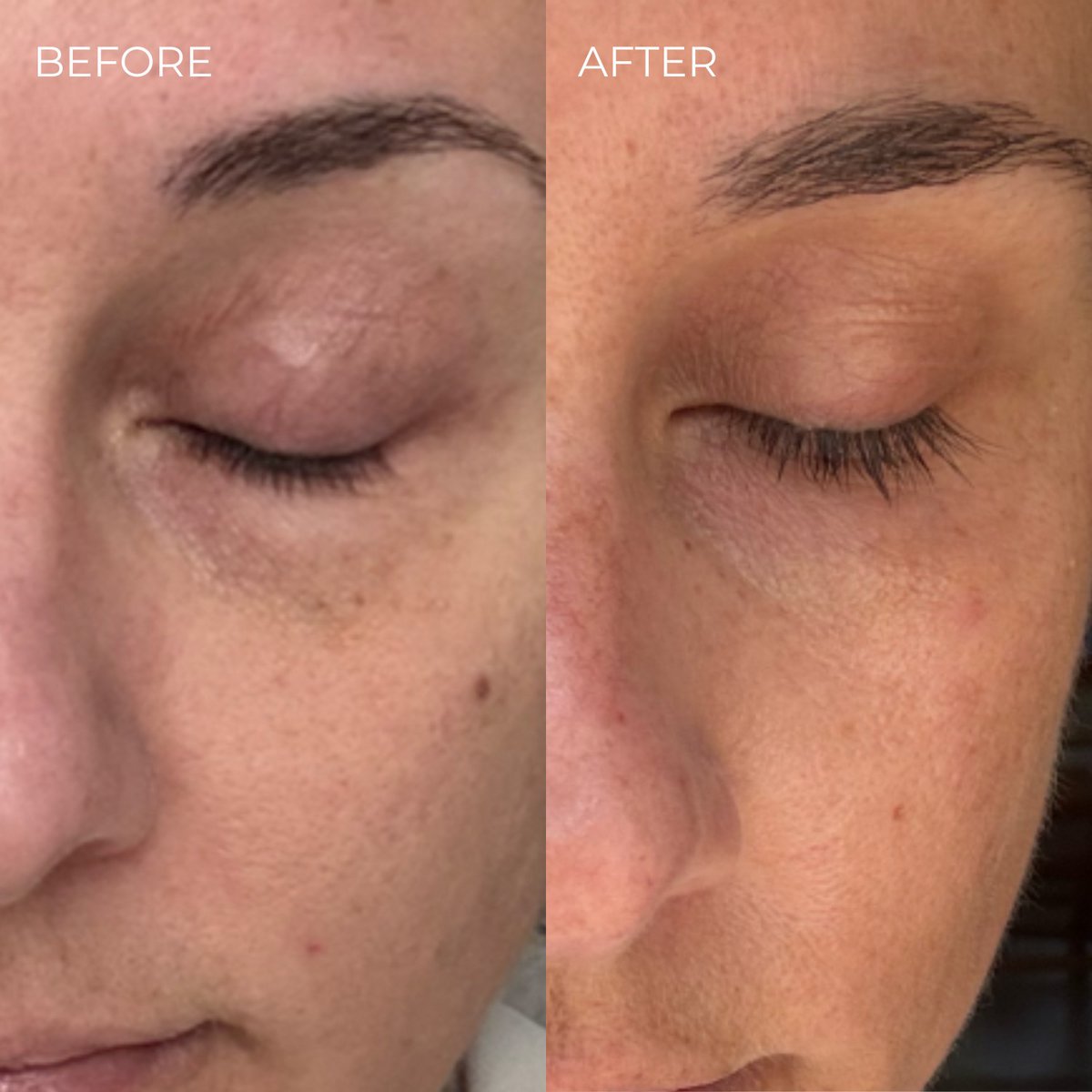 Eyelash Enhancing Serum