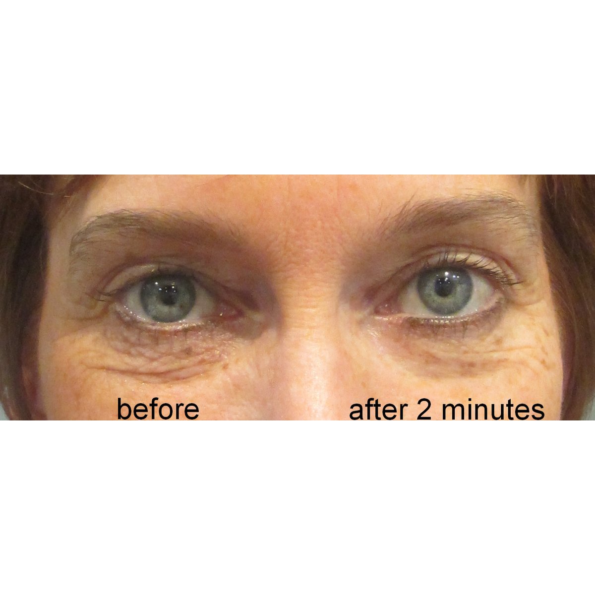 SUPREME DIRECT EYE LIFT - sofortiges Augenlifting - Ergebnisse in 2 Minuten