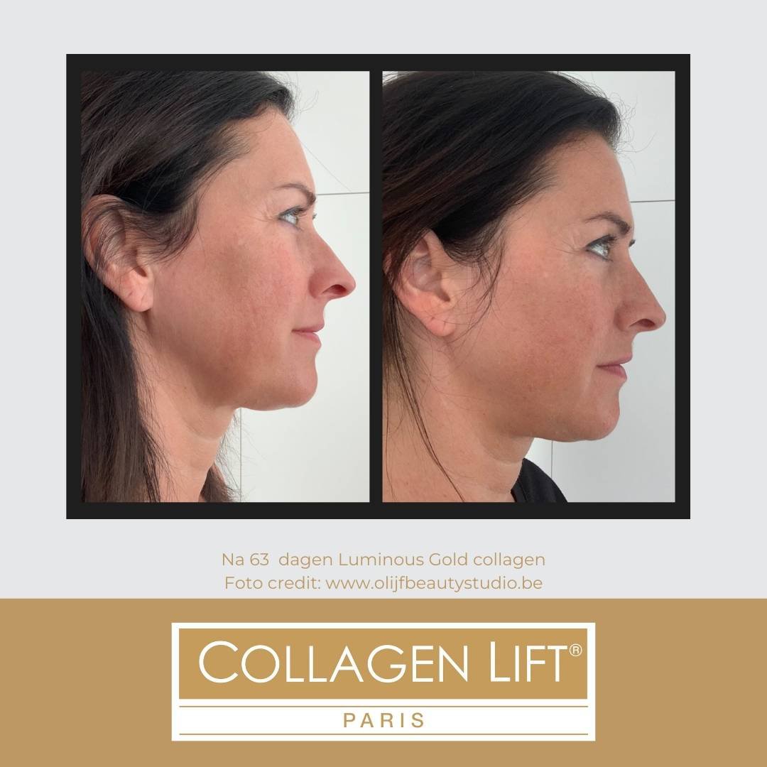 Luminous Gold: anti-age collagen for wrinkles and sun damage
