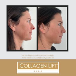 Luminous Gold: anti-age collagen for wrinkles and sun damage