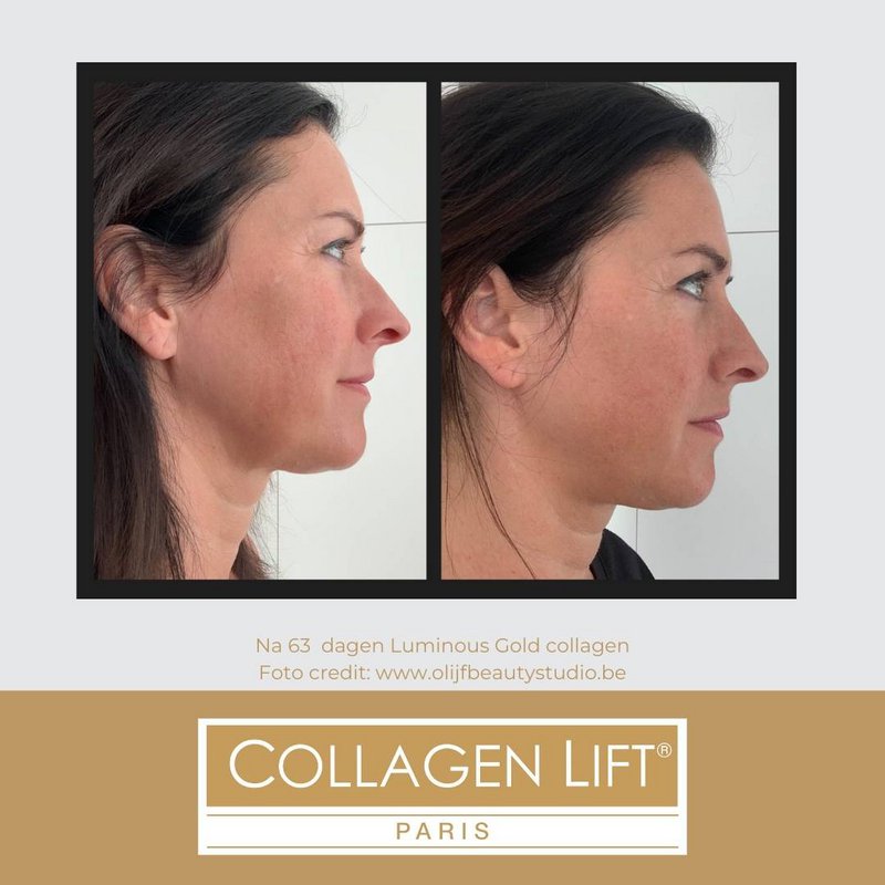 Luminous Gold: anti-age collagen for wrinkles and sun damage