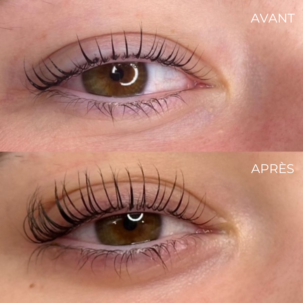 Eyelash Enhancing Serum
