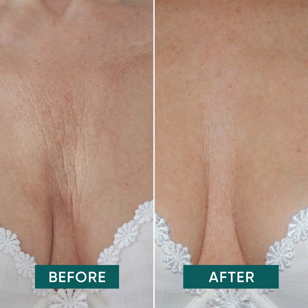 APRICOT Reusable Décolleté Pad with Ectoin