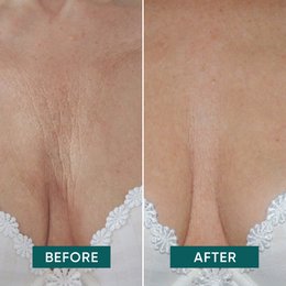 APRICOT Reusable Décolleté Pad with Ectoin