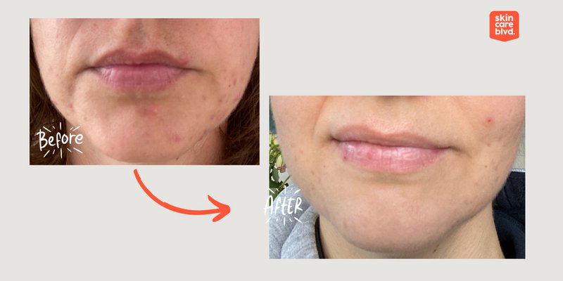 Synbiotic Skin Serum med probiotika