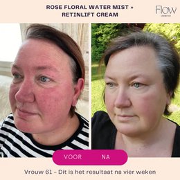 RetinLift 3-in-1 – Retinol-Creme