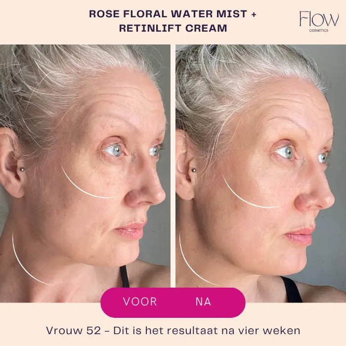 RetinLift 3-in-1 – Retinol-Creme