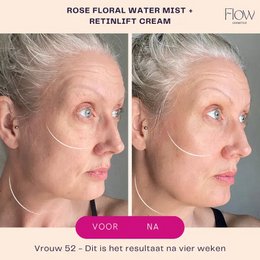 RetinLift 3-in-1 – Retinol-Creme