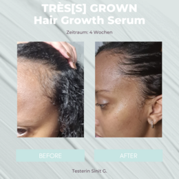 TRÈS[S] GROWN - HAIR GROWTH SERUM
