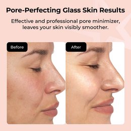 VIP 7-Second Luxury All-Day Mask™ – 5er-Pack