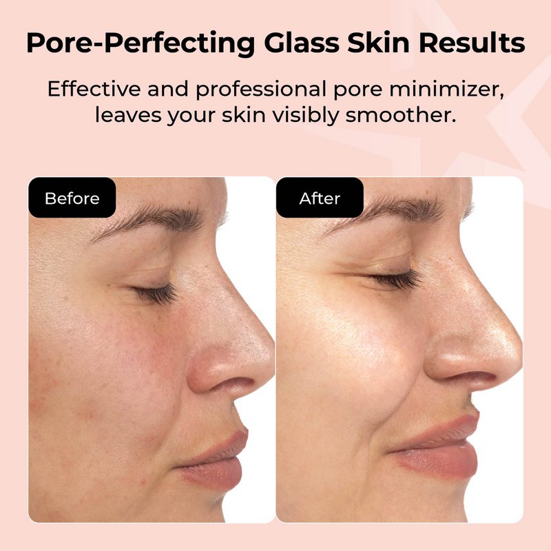 VIP 7-Second Luxury All-Day Mask™ – 5er-Pack