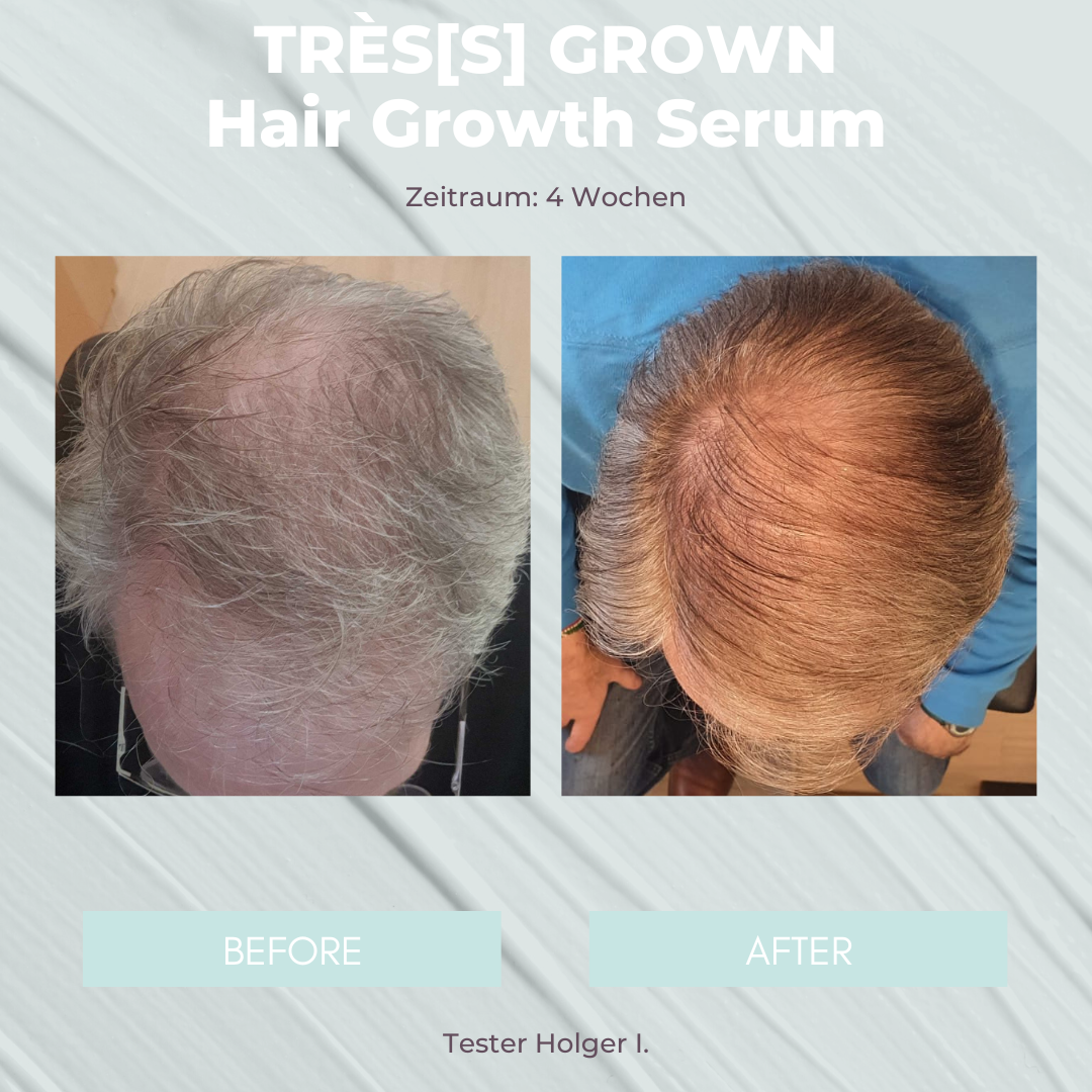 TRÈS[S] GROWN - HAIR GROWTH SERUM