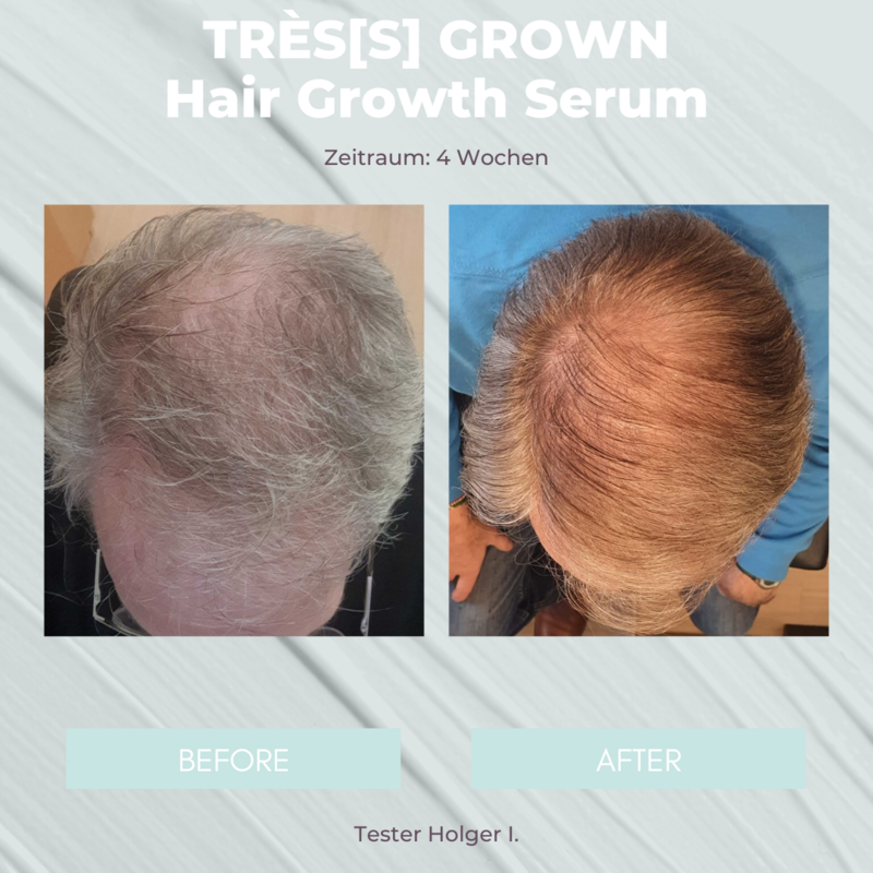TRÈS[S] GROWN - HAIR GROWTH SERUM