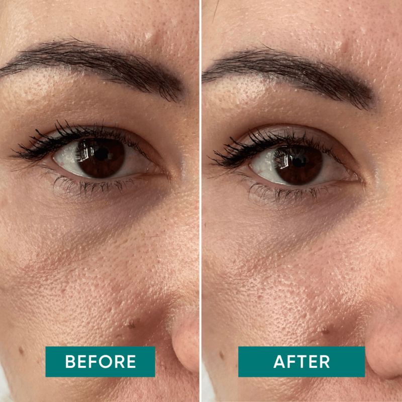 APRICOT Eyelid Tapes