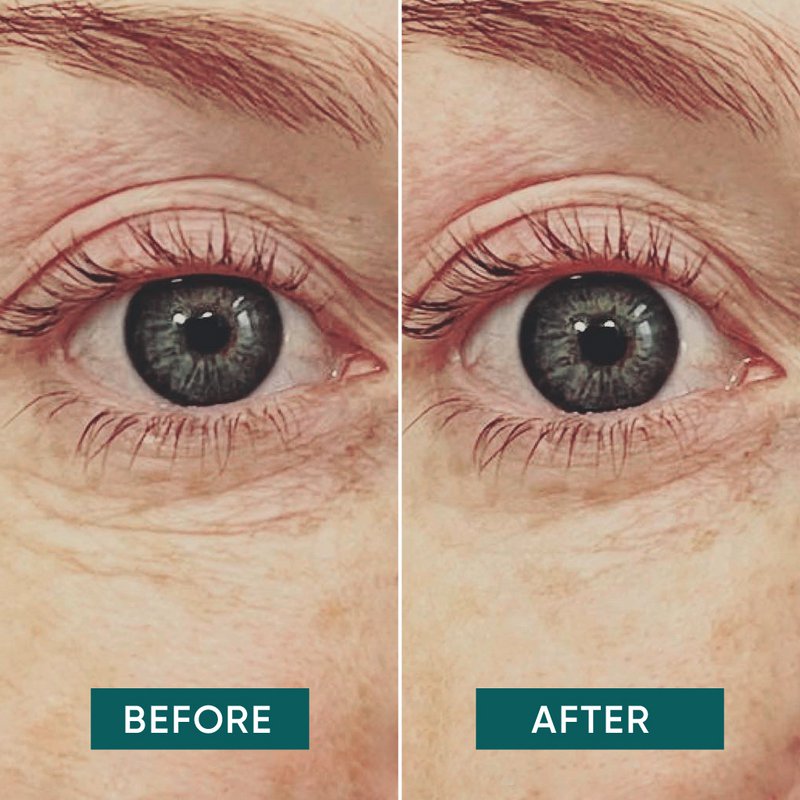 APRICOT Reusable Eye Pads with Vitamin C