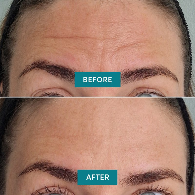 APRICOT Reusable Forehead Pad with Ectoin