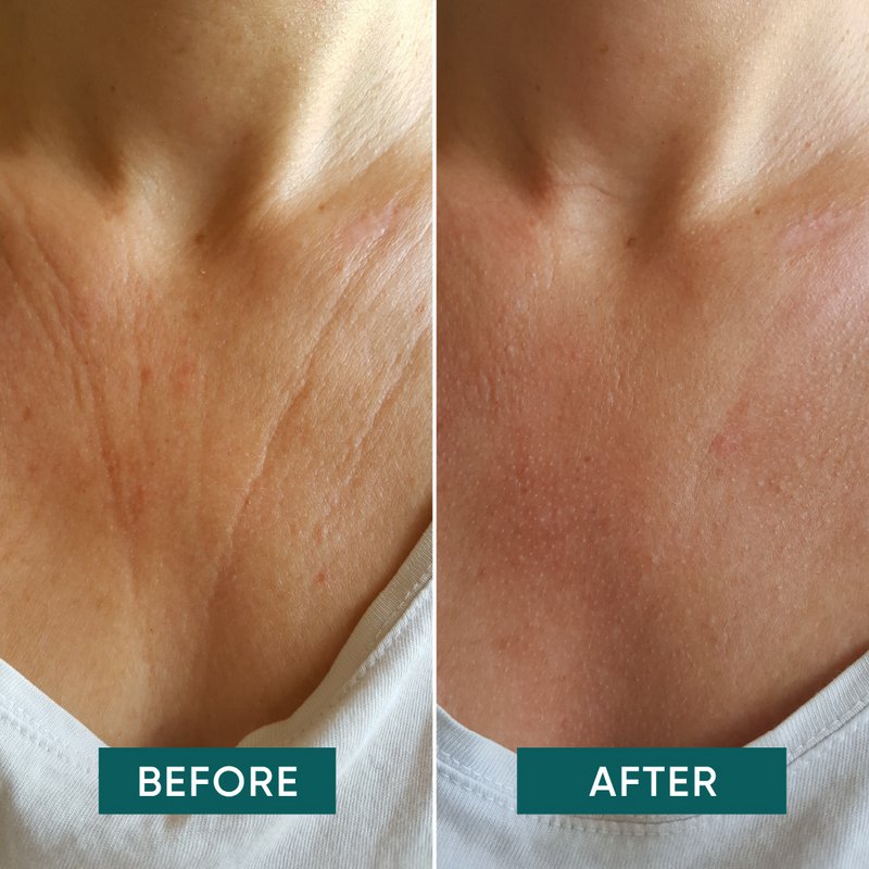 APRICOT Decolleté Pad with Hyaluron