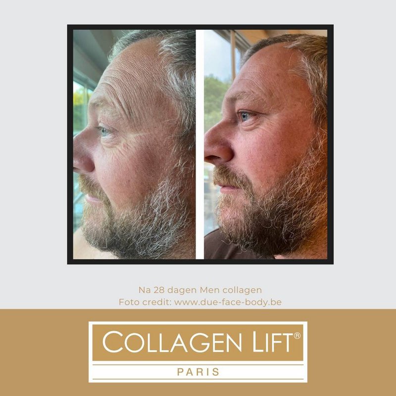 MEN: anti-wrinkle collagen for men